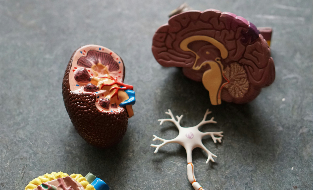 Down Syndrome Alzheimers Study